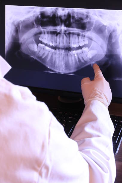 Best Emergency Dental Care for Abscessed Tooth in Lindsay, OK