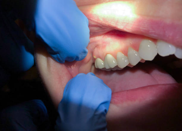Best Mobile Emergency Dentist in Lindsay, OK